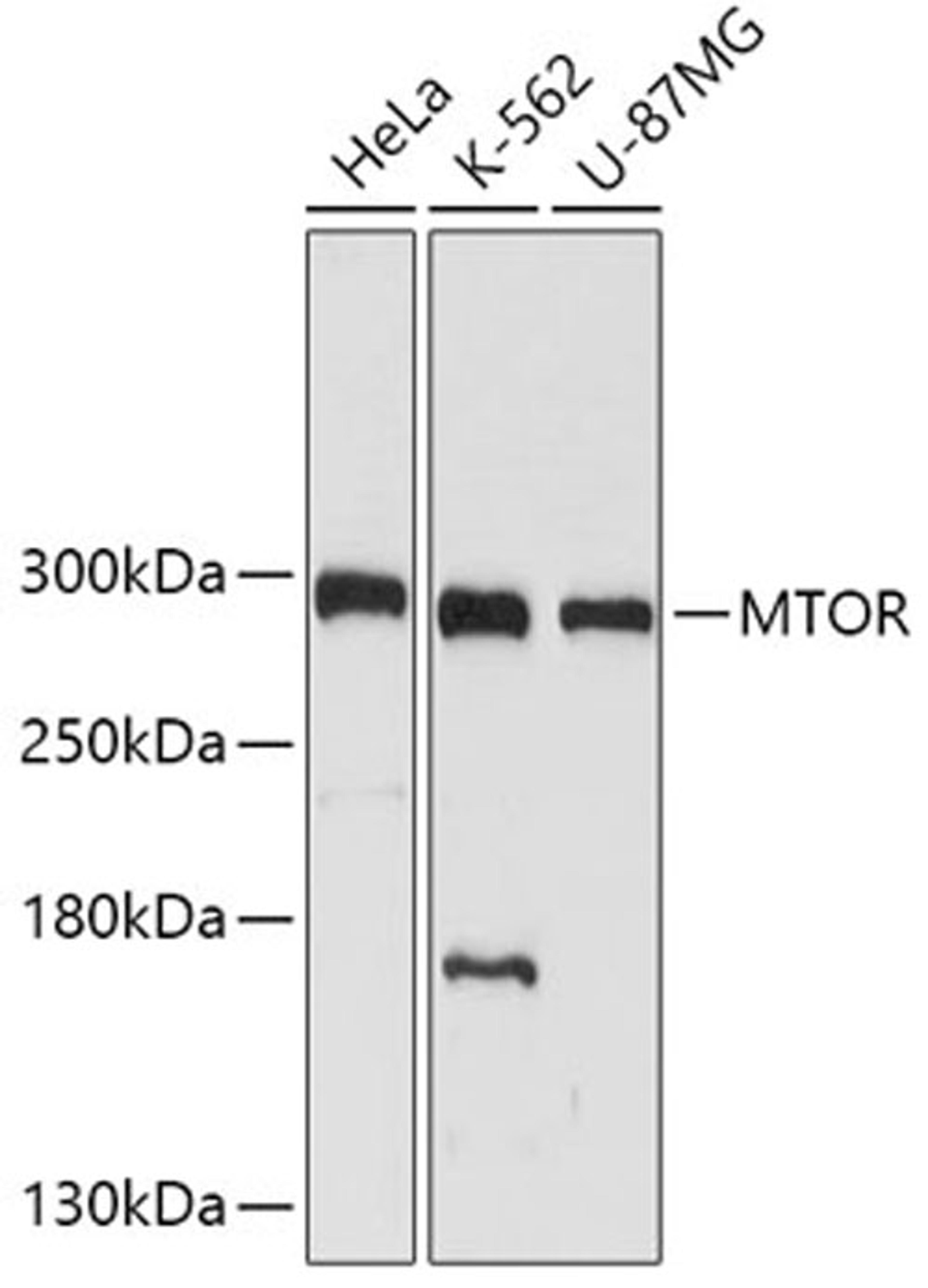 Western blot - mTOR  antibody (A2445)