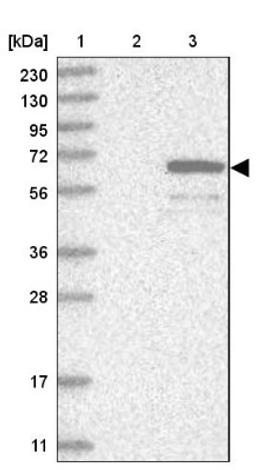 Western Blot: WDR49 Antibody [NBP1-83510] - Lane 1: Marker [kDa] 230, 130, 95, 72, 56, 36, 28, 17, 11<br/>Lane 2: Human cell line RT-4<br/>Lane 3: Human cell line U-251MG sp