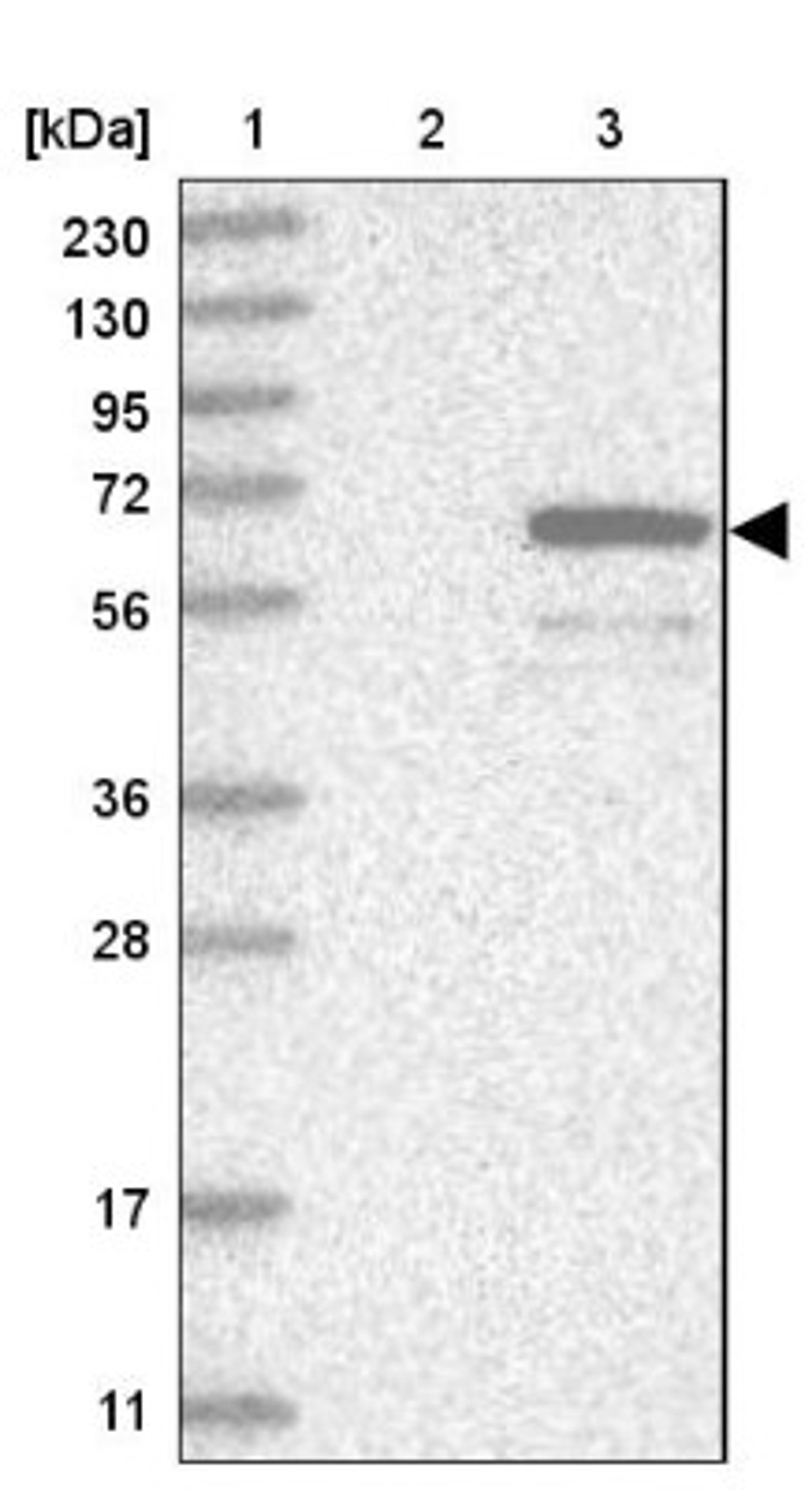 Western Blot: WDR49 Antibody [NBP1-83510] - Lane 1: Marker [kDa] 230, 130, 95, 72, 56, 36, 28, 17, 11<br/>Lane 2: Human cell line RT-4<br/>Lane 3: Human cell line U-251MG sp