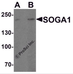 Western blot analysis of SOGA1 in Hela cell lysate with SOGA1 antibody at (A) 1 and (B) 2 &#956;g/ml.