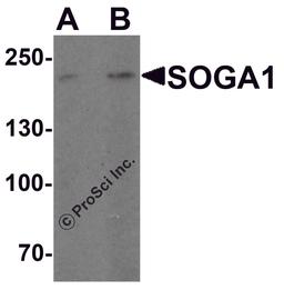 Western blot analysis of SOGA1 in Hela cell lysate with SOGA1 antibody at (A) 1 and (B) 2 μg/ml.