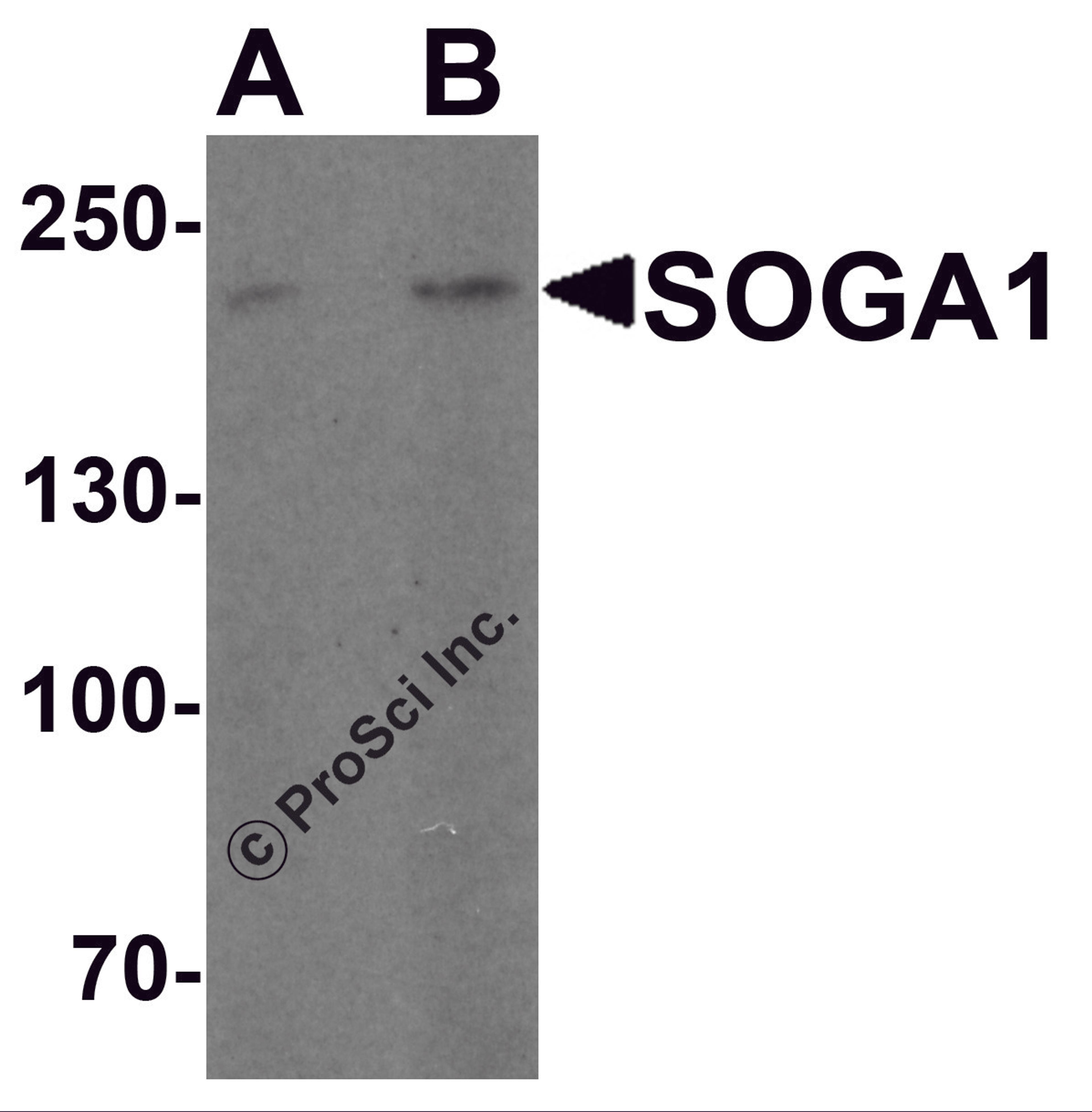 Western blot analysis of SOGA1 in Hela cell lysate with SOGA1 antibody at (A) 1 and (B) 2 μg/ml.