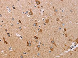 The image on the left is immunohistochemistry of paraffin-embedded Human brain tissue using CSB-PA075471(ATP5J Antibody) at dilution 1/15, on the right is treated with fusion protein. (Original magnification: ×200)