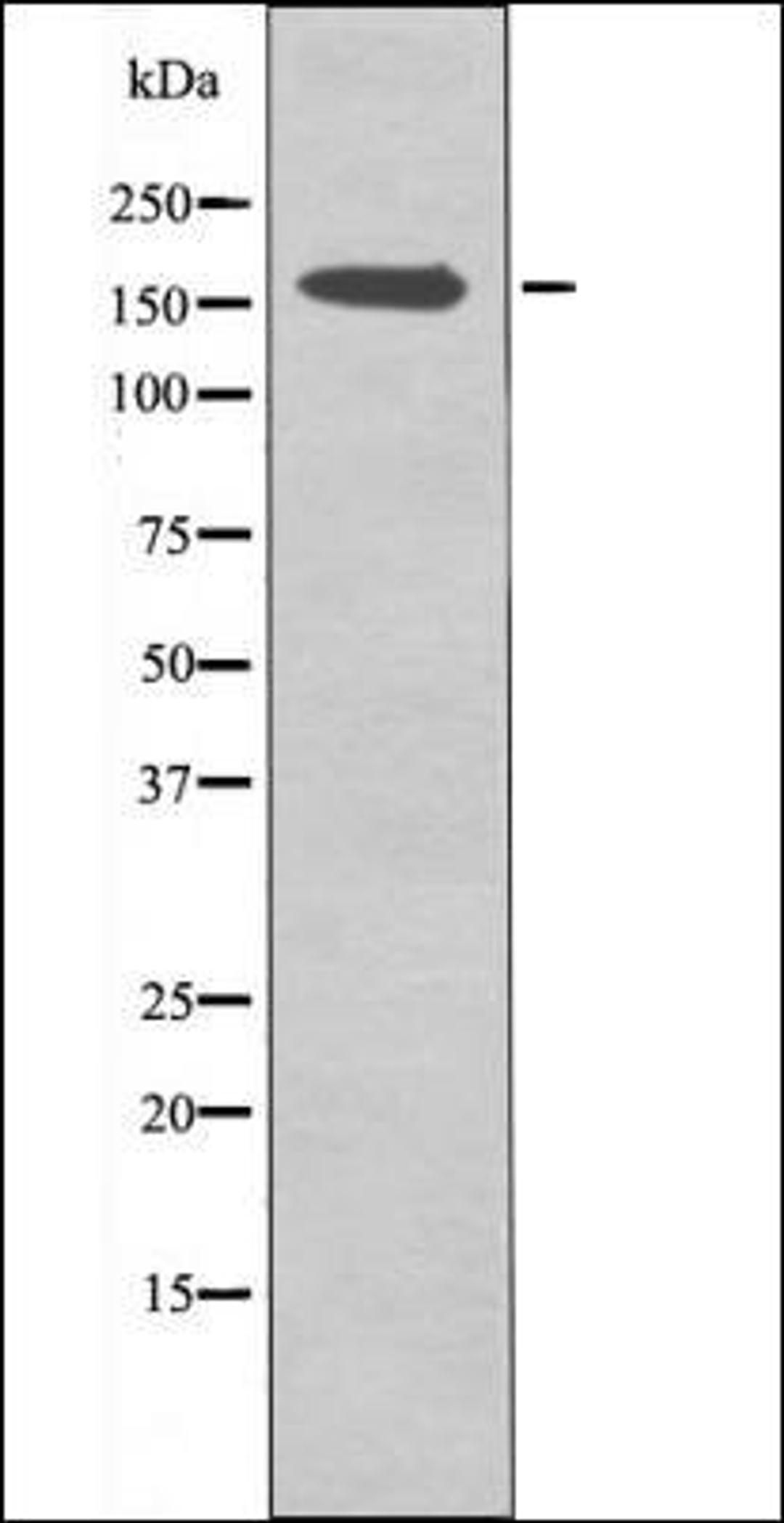 Western blot analysis of COLO205 whole cell lysates using CFTR -Phospho-Ser737- antibody