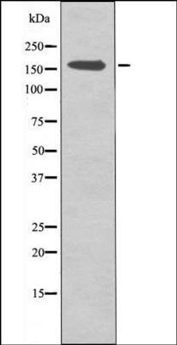 Western blot analysis of COLO205 whole cell lysates using CFTR -Phospho-Ser737- antibody