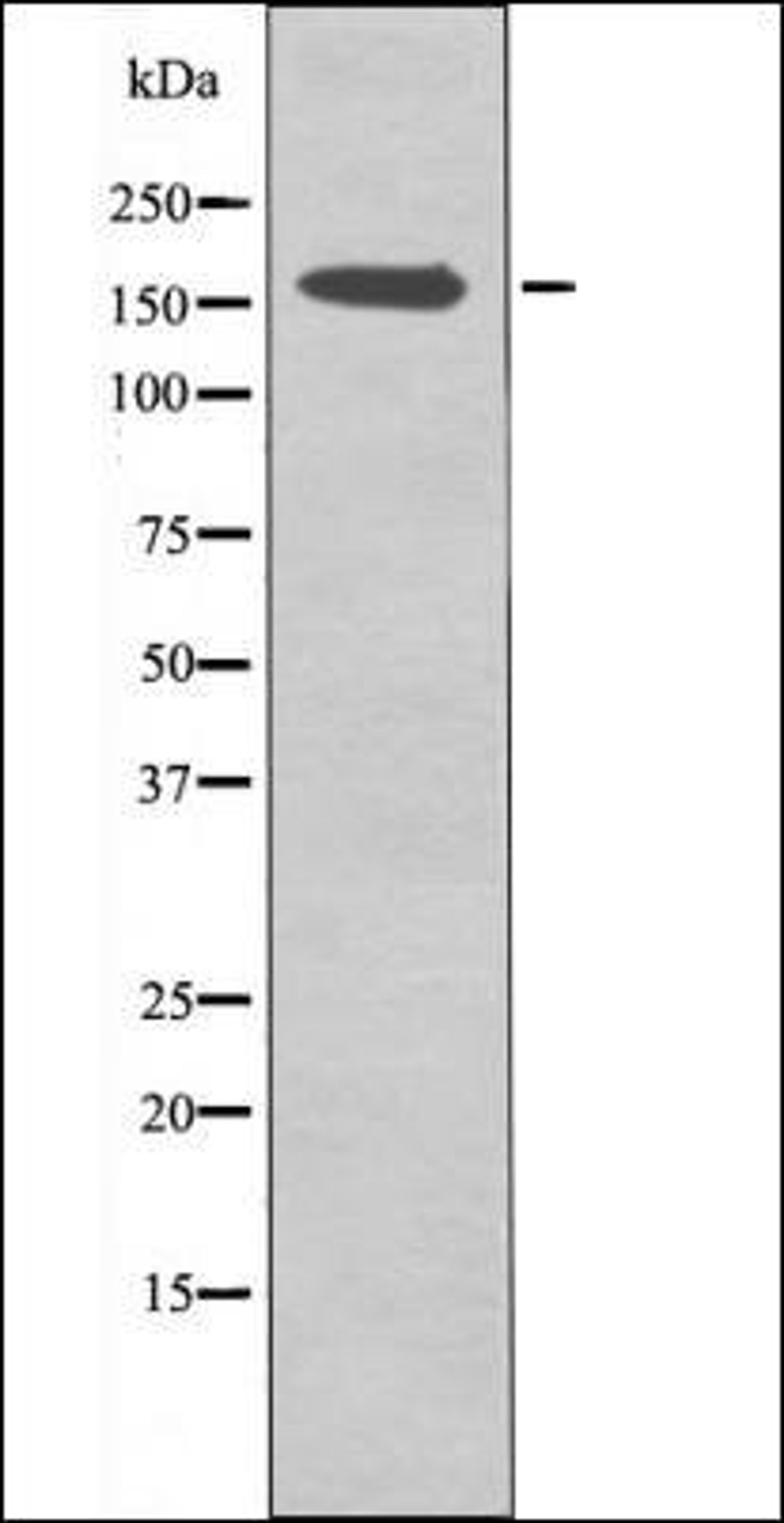 Western blot analysis of COLO205 whole cell lysates using CFTR -Phospho-Ser737- antibody