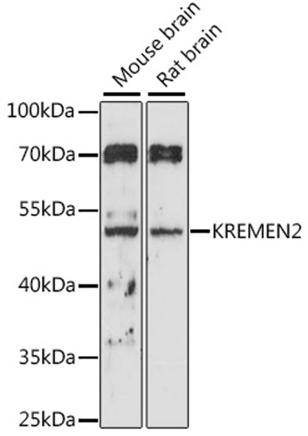 Western blot - KREMEN2 antibody (A16202)