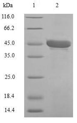 (Tris-Glycine gel) Discontinuous SDS-PAGE (reduced) with 5% enrichment gel and 15% separation gel.