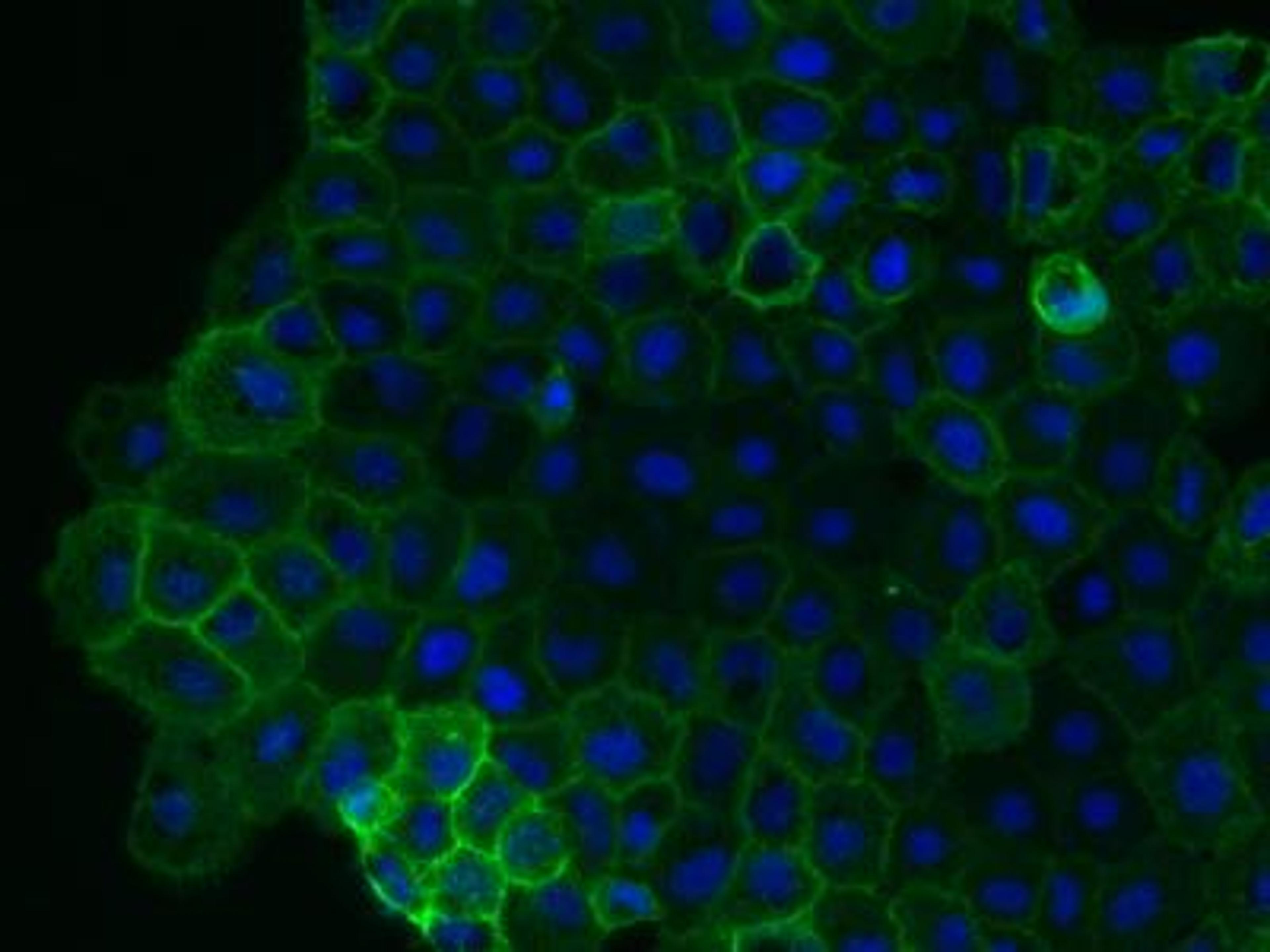 Immunocytochemistry/Immunofluorescence: CD44 Antibody (MEM-263) [NB500-481] - analysis of CD44 in 4% paraformaldehyde fixed Caov-3 cells (adherent human ovarian cancer cells) using anti-Cd44 antibody. The primary antibody was used at a dilution of 1:1000 in 2% goat serum in PBS and incubated for 2 hours at room temperature. Image from verified customer review.