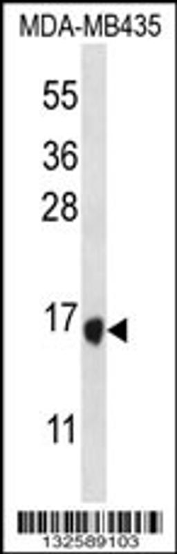 Western blot analysis in MDA-MB435 cell line lysates (35ug/lane).