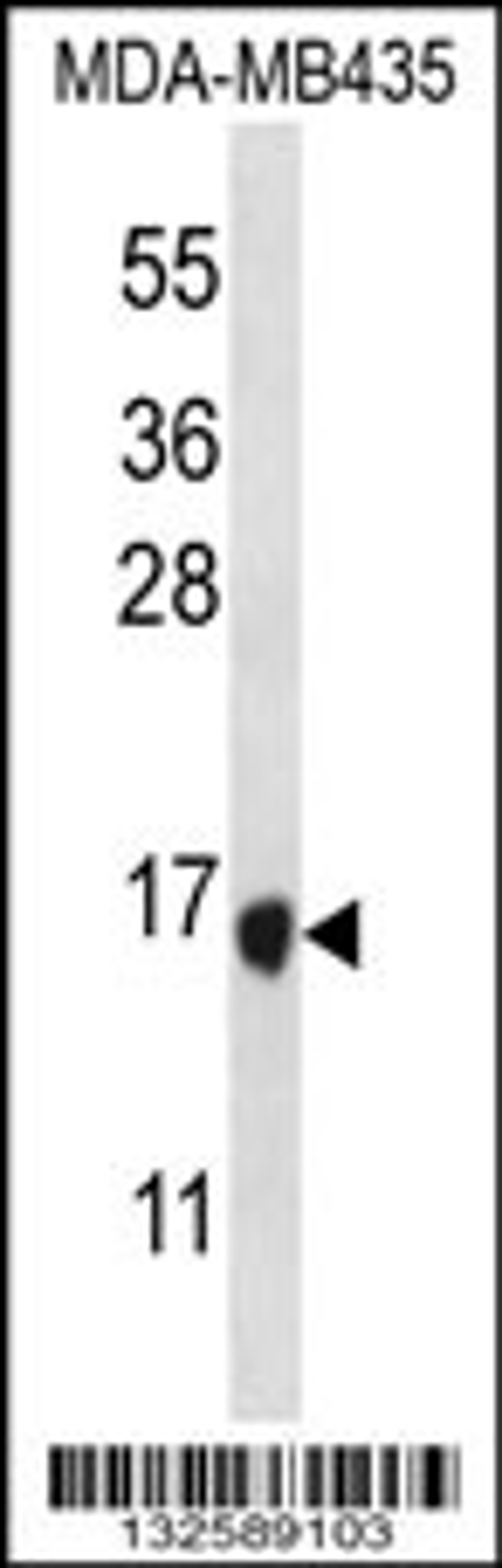 Western blot analysis in MDA-MB435 cell line lysates (35ug/lane).