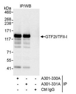 Detection of human GTF2I/TFII-I by western blot of immunoprecipitates.