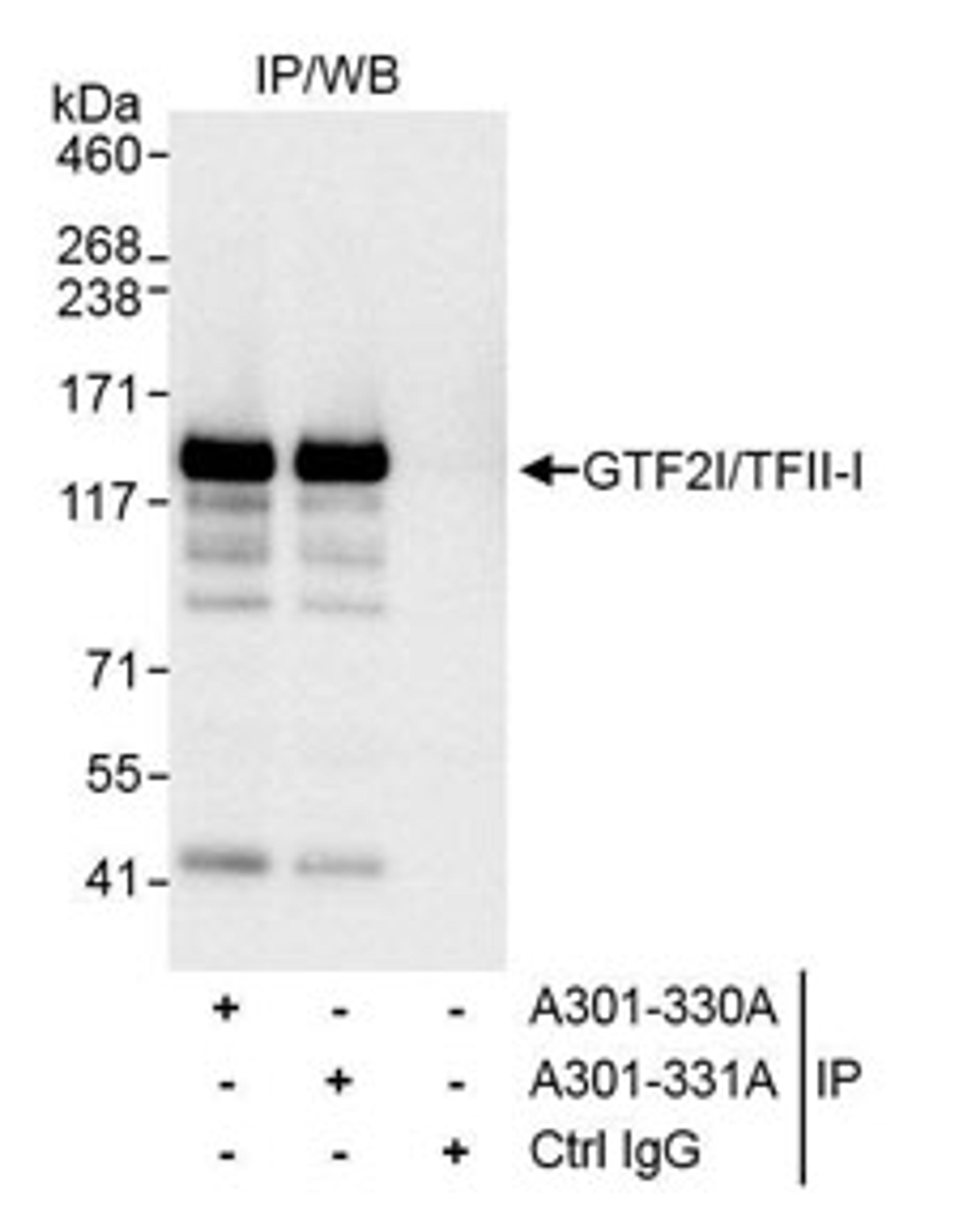 Detection of human GTF2I/TFII-I by western blot of immunoprecipitates.