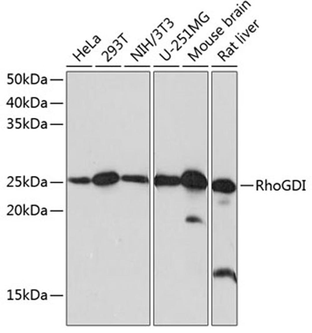 Western blot - RhoGDI Rabbit mAb (A11556)