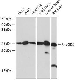 Western blot - RhoGDI Rabbit mAb (A11556)