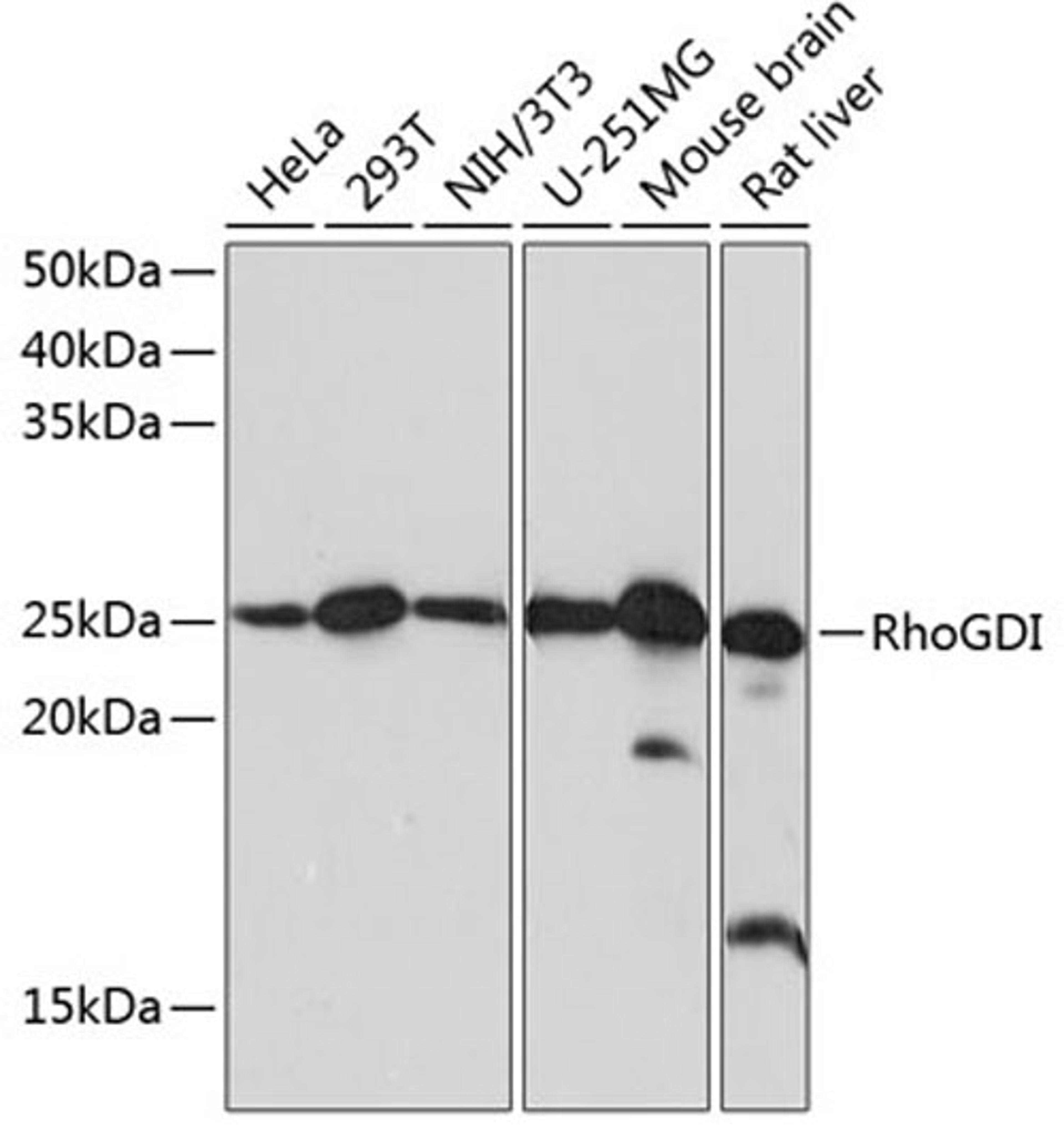 Western blot - RhoGDI Rabbit mAb (A11556)