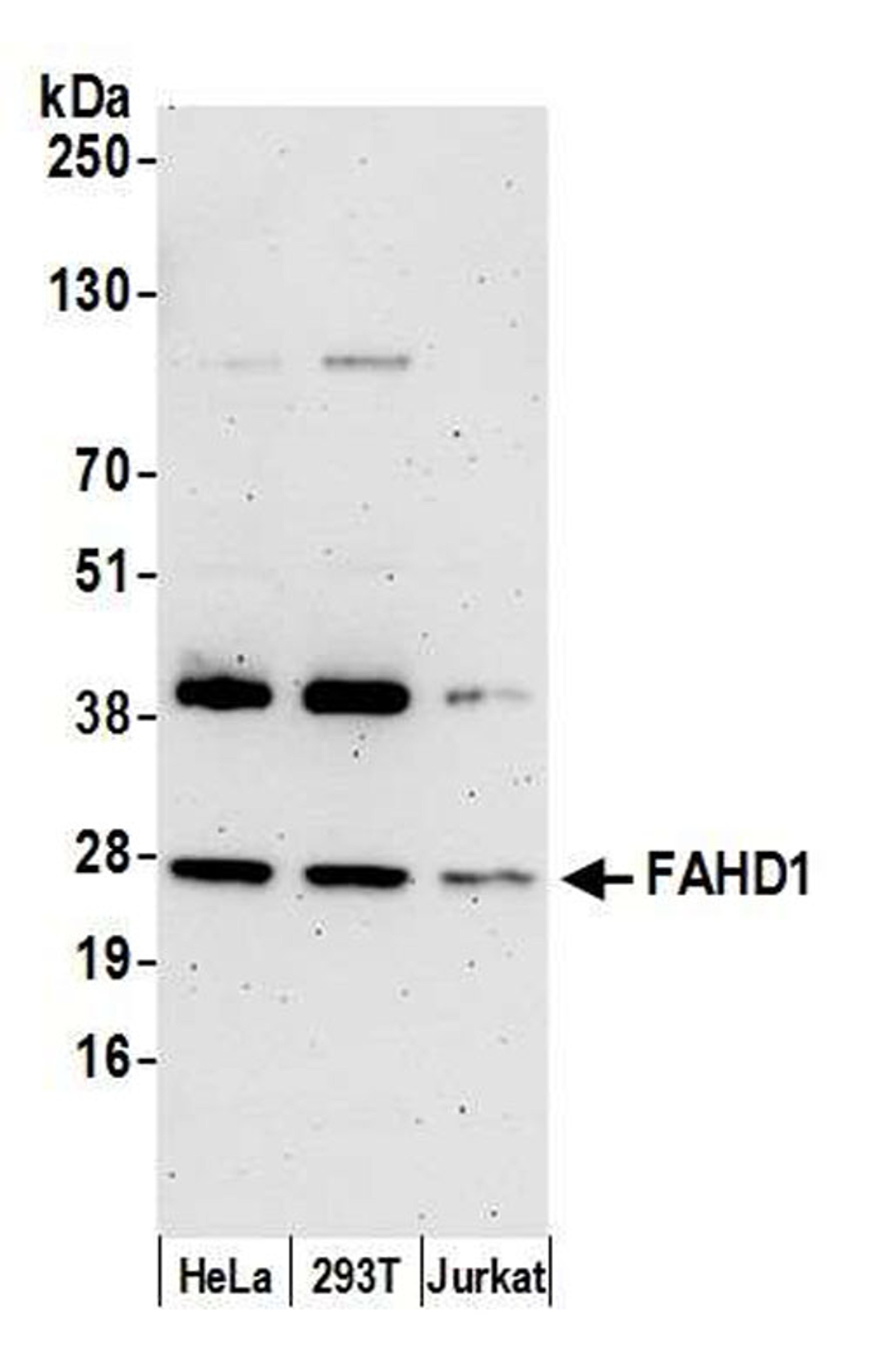 Detection of human FAHD1 by WB.