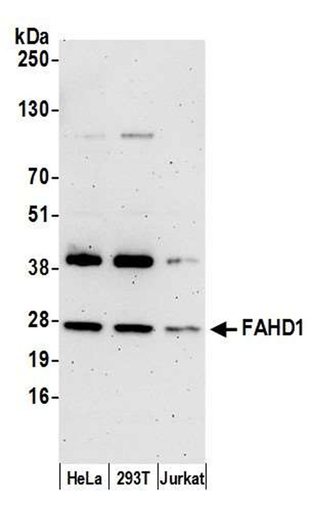 Detection of human FAHD1 by WB.