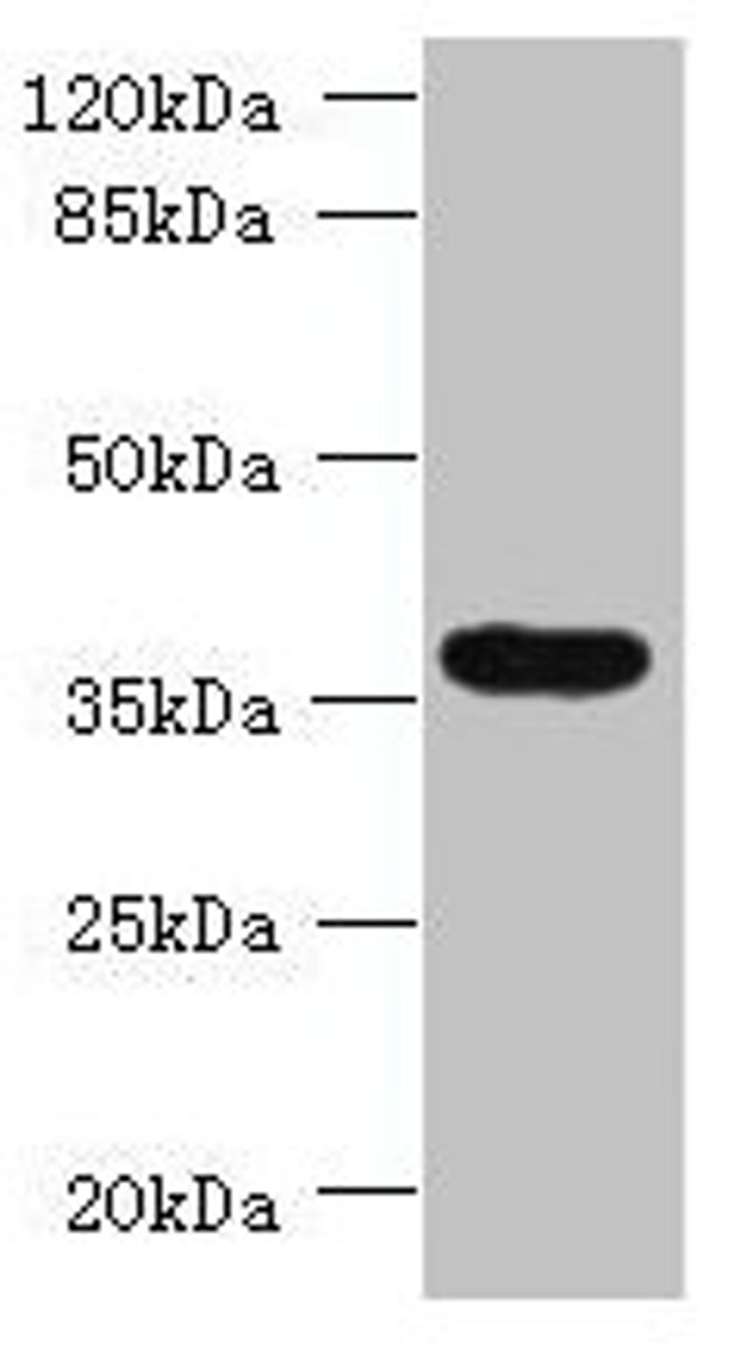 Western blot. All lanes: TRIM51 antibody at 1.2µg/ml + Jurkat whole cell lysate. Secondary. Goat polyclonal to rabbit IgG at 1/10000 dilution. Predicted band size: 53, 36 kDa. Observed band size: 36 kDa