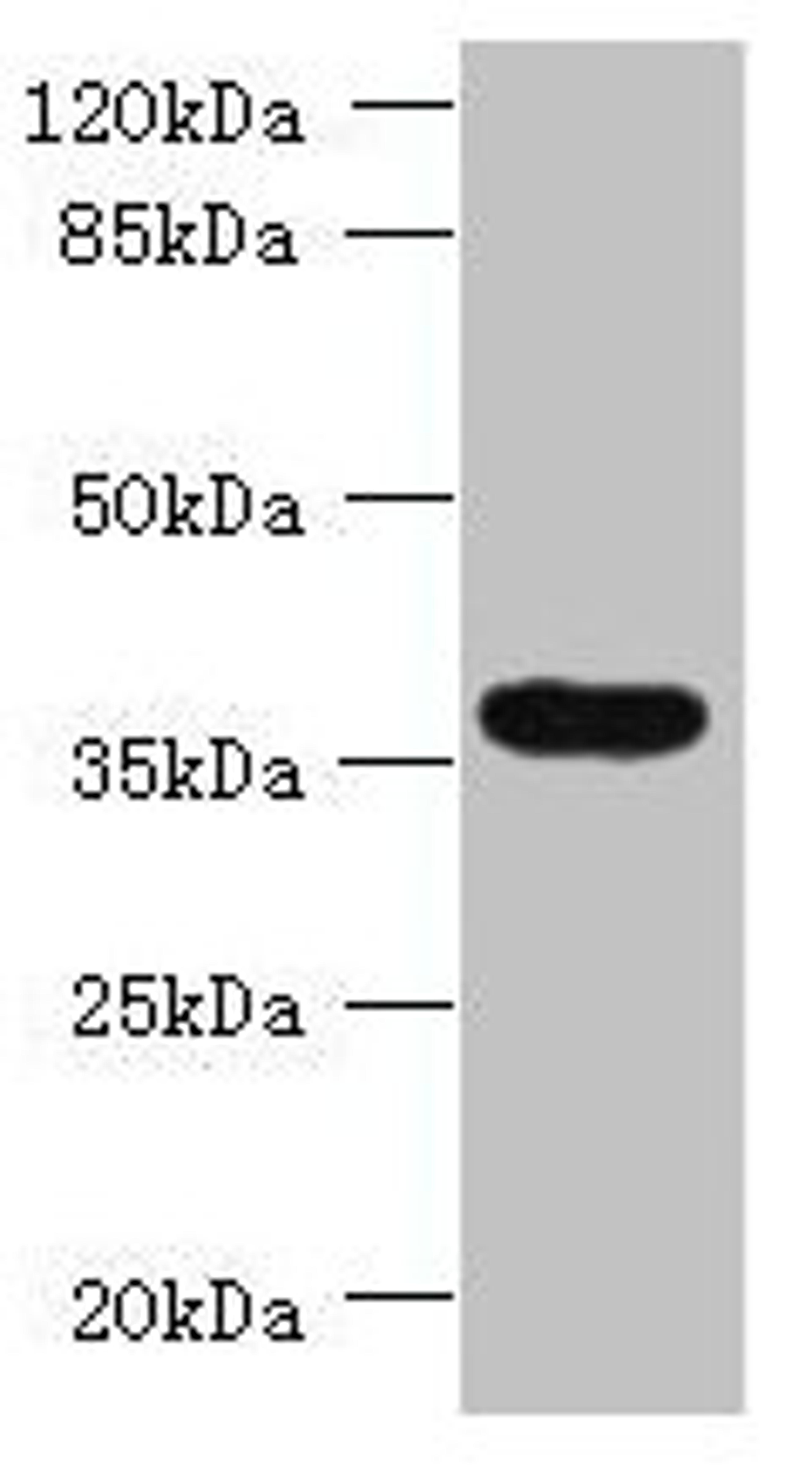 Western blot. All lanes: TRIM51 antibody at 1.2µg/ml + Jurkat whole cell lysate. Secondary. Goat polyclonal to rabbit IgG at 1/10000 dilution. Predicted band size: 53, 36 kDa. Observed band size: 36 kDa