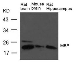 Western blot analysis of rat brain Mouse brain and rat hippocampus tissue using MBP(myelin basic protein) antibody