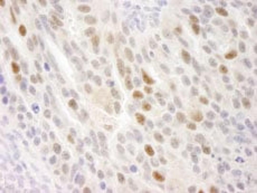 Detection of human KIFC1 by immunohistochemistry.