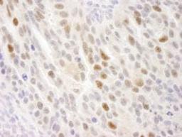 Detection of human KIFC1 by immunohistochemistry.