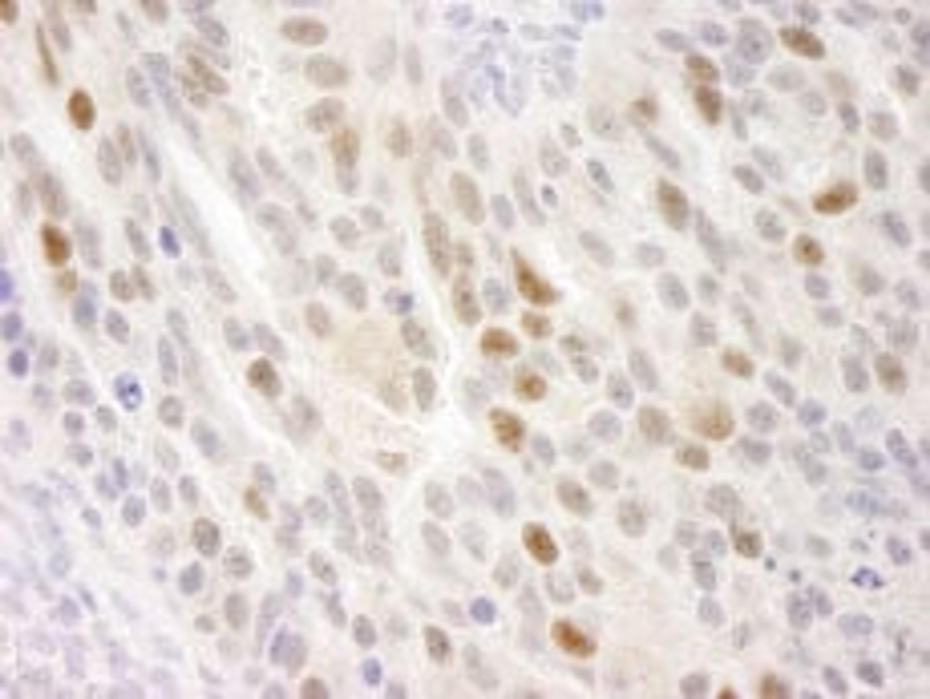 Detection of human KIFC1 by immunohistochemistry.