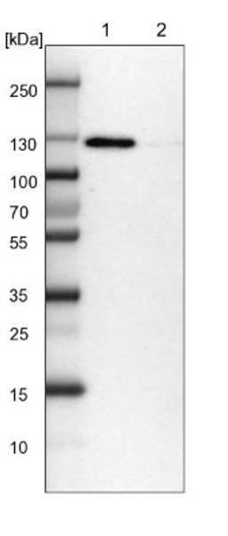 Western Blot: RAI14 Antibody [NBP1-94075] - Lane 1: NIH-3T3 cell lysate (Mouse embryonic fibroblast cells)<br/>Lane 2: NBT-II cell lysate (Rat Wistar bladder tumour cells)