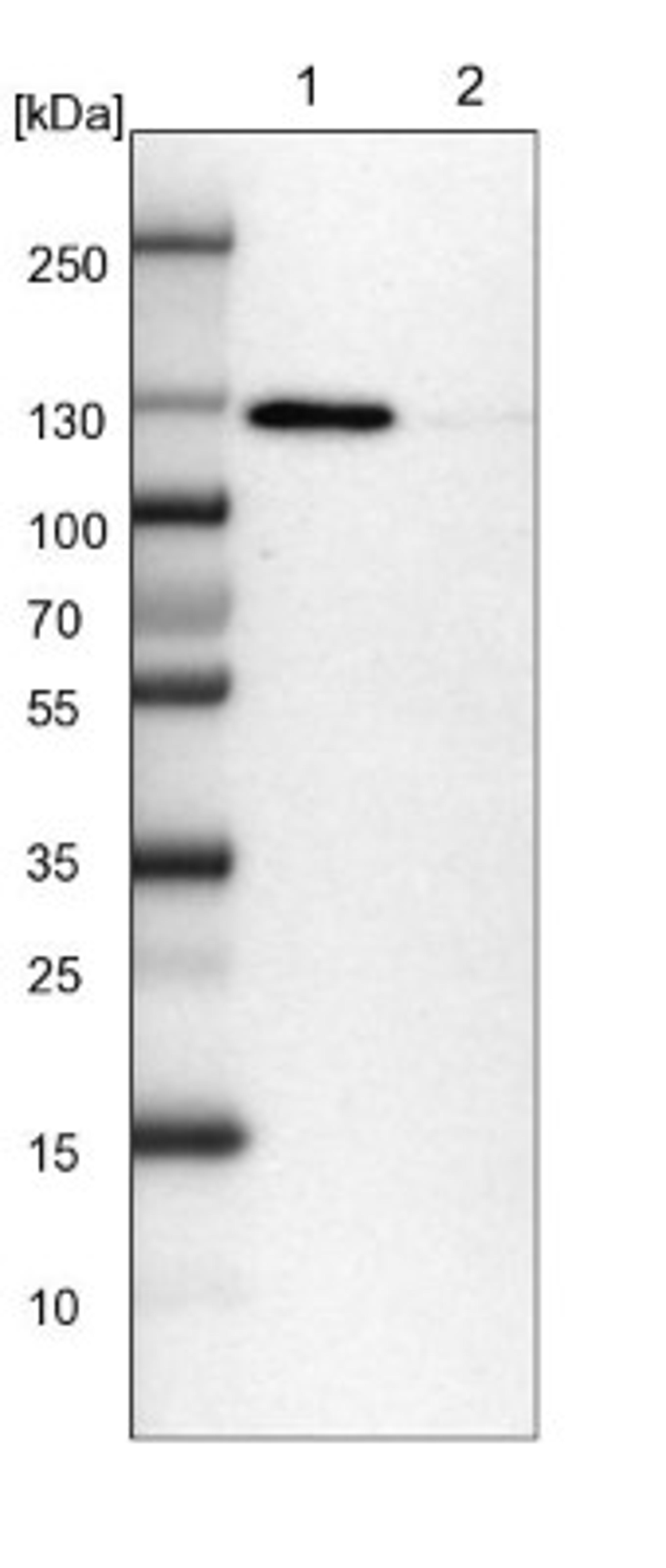 Western Blot: RAI14 Antibody [NBP1-94075] - Lane 1: NIH-3T3 cell lysate (Mouse embryonic fibroblast cells)<br/>Lane 2: NBT-II cell lysate (Rat Wistar bladder tumour cells)