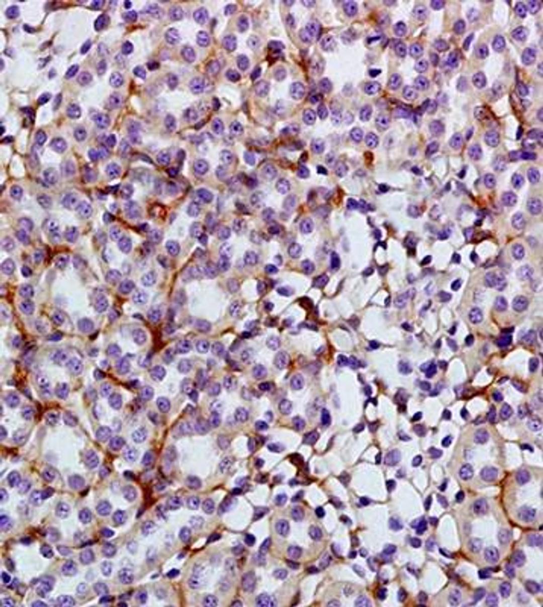 Immunohistochemical analysis of formalin fixed and paraffin embedded rat kidney tissue using GLUT4 antibody