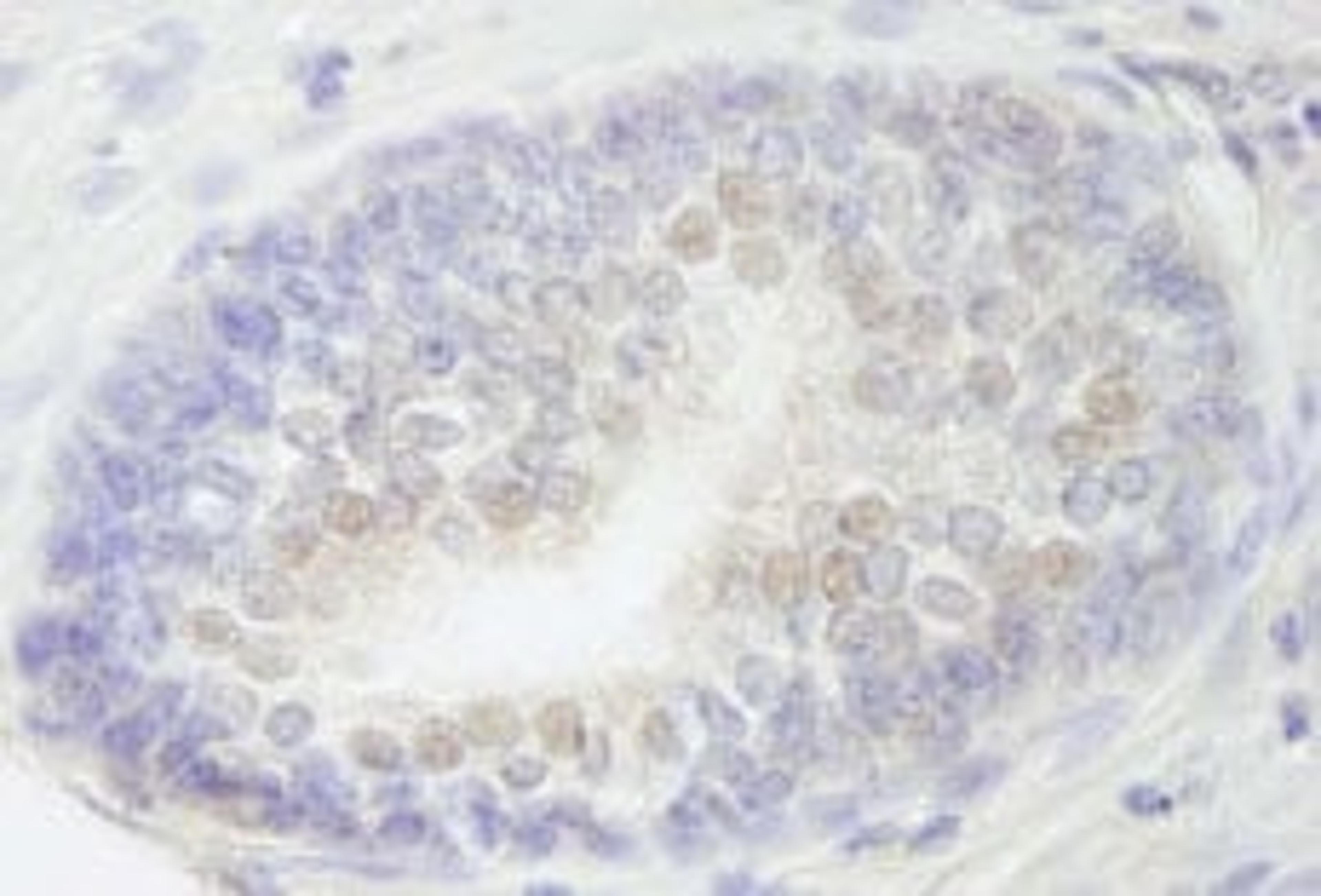 Detection of human RBM27 by immunohistochemistry.