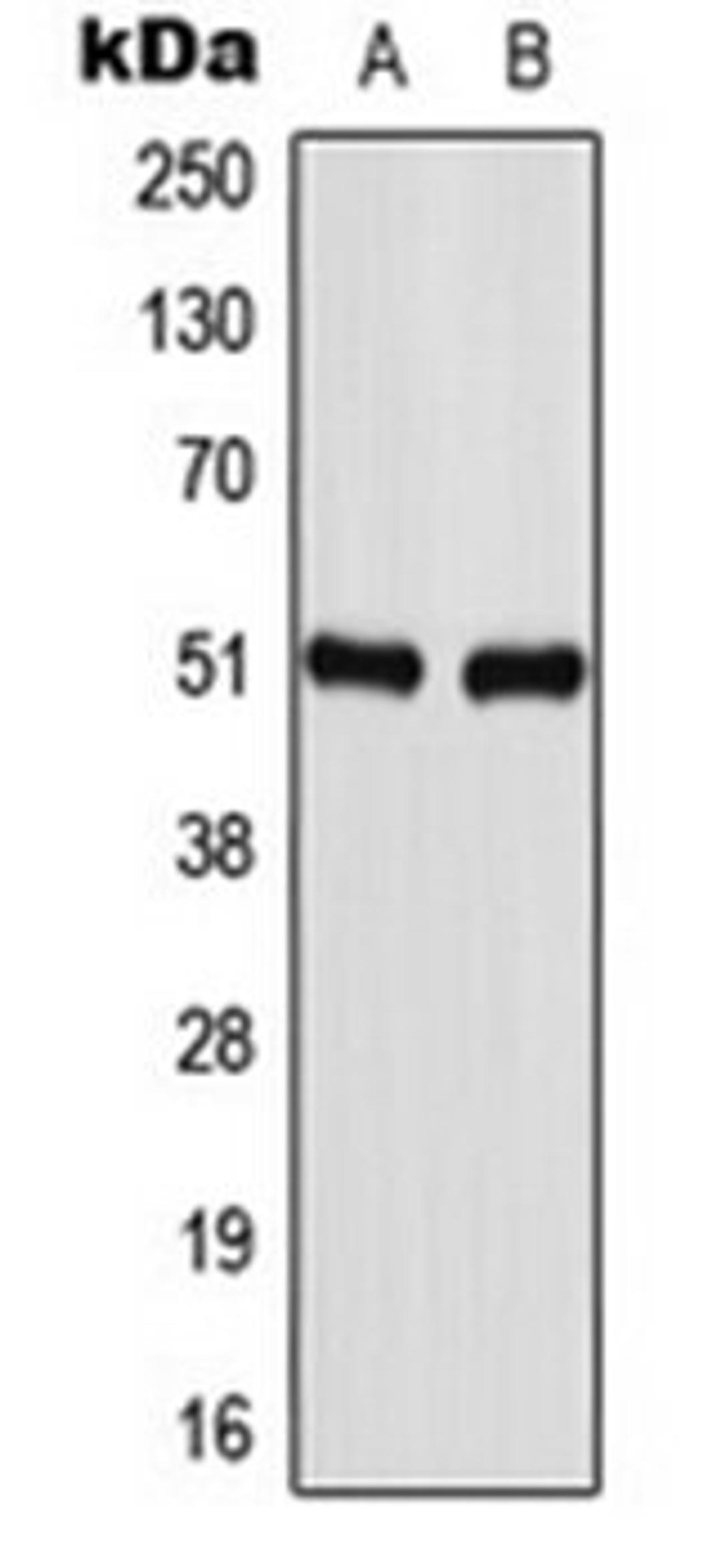 Western blot analysis of U87MG (Lane 1), NIH3T3 (Lane 2) whole cell lysates using GABRA1 antibody