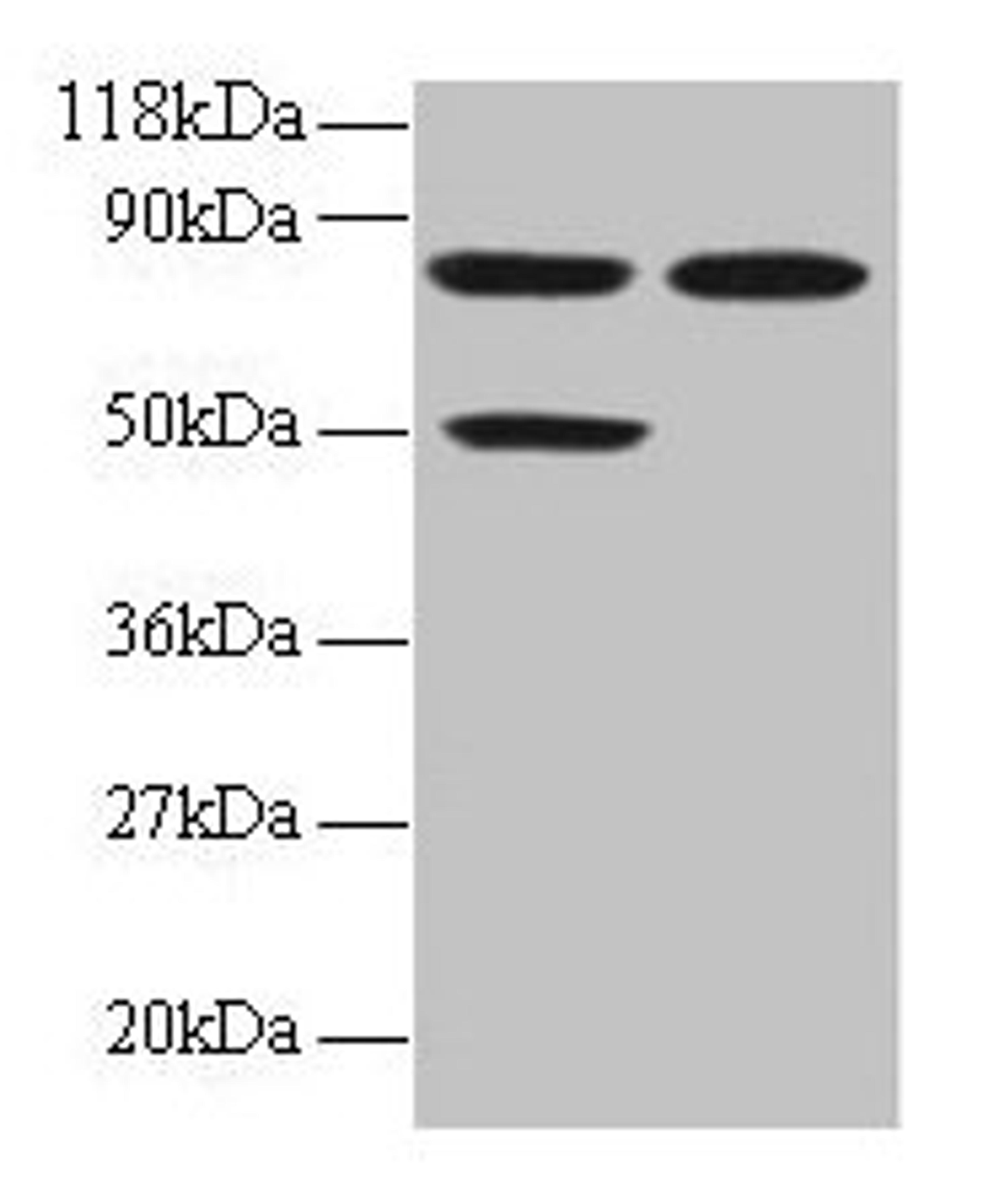 Western blot. All lanes: CCL22 antibody at 2µg/ml. Lane 1: 293T whole cell lysate. Lane 2: EC109 whole cell lysate. Secondary. Goat polyclonal to rabbit IgG at 1/15000 dilution. Predicted band size: 11 kDa. Observed band size: 50, 80 kDa