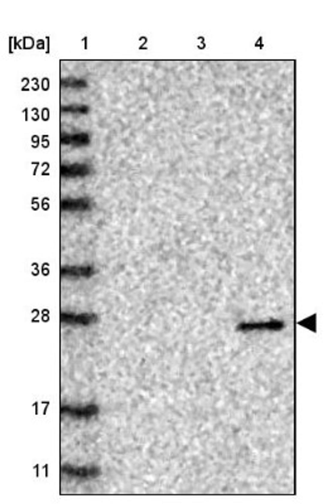 Western Blot: VSTM2A Antibody [NBP1-81114] - Lane 1: Marker [kDa] 230, 130, 95, 72, 56, 36, 28, 17, 11<br/>Lane 2: Human cell line RT-4<br/>Lane 3: Human cell line U-251MG sp<br/>Lane 4: Human plasma (IgG/HSA depleted)