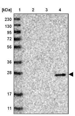 Western Blot: VSTM2A Antibody [NBP1-81114] - Lane 1: Marker [kDa] 230, 130, 95, 72, 56, 36, 28, 17, 11<br/>Lane 2: Human cell line RT-4<br/>Lane 3: Human cell line U-251MG sp<br/>Lane 4: Human plasma (IgG/HSA depleted)