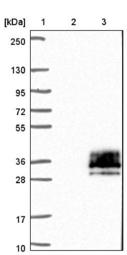 Western Blot: TSPAN15 Antibody [NBP1-92540] - Lane 1: Marker [kDa] 250, 130, 95, 72, 55, 36, 28, 17, 10<br/>Lane 2: Negative control (vector only transfected HEK293T lysate)<br/>Lane 3: Over-expression lysate (Co-expressed with a C-terminal myc-DDK tag (~3.1 kDa) in mammalian HEK293T cells, LY402201)