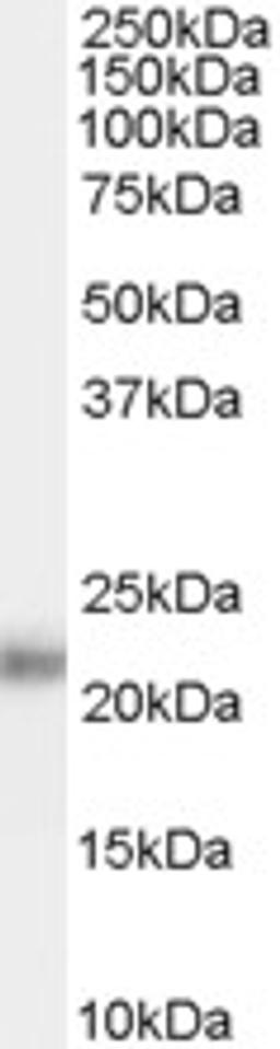 45-808 (0.1ug/ml) staining of Human Prostate lysate (35ug protein in RIPA buffer). Primary incubation was 1 hour. Detected by chemiluminescence.