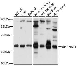 Western blot - GNPNAT1 antibody (A17759)