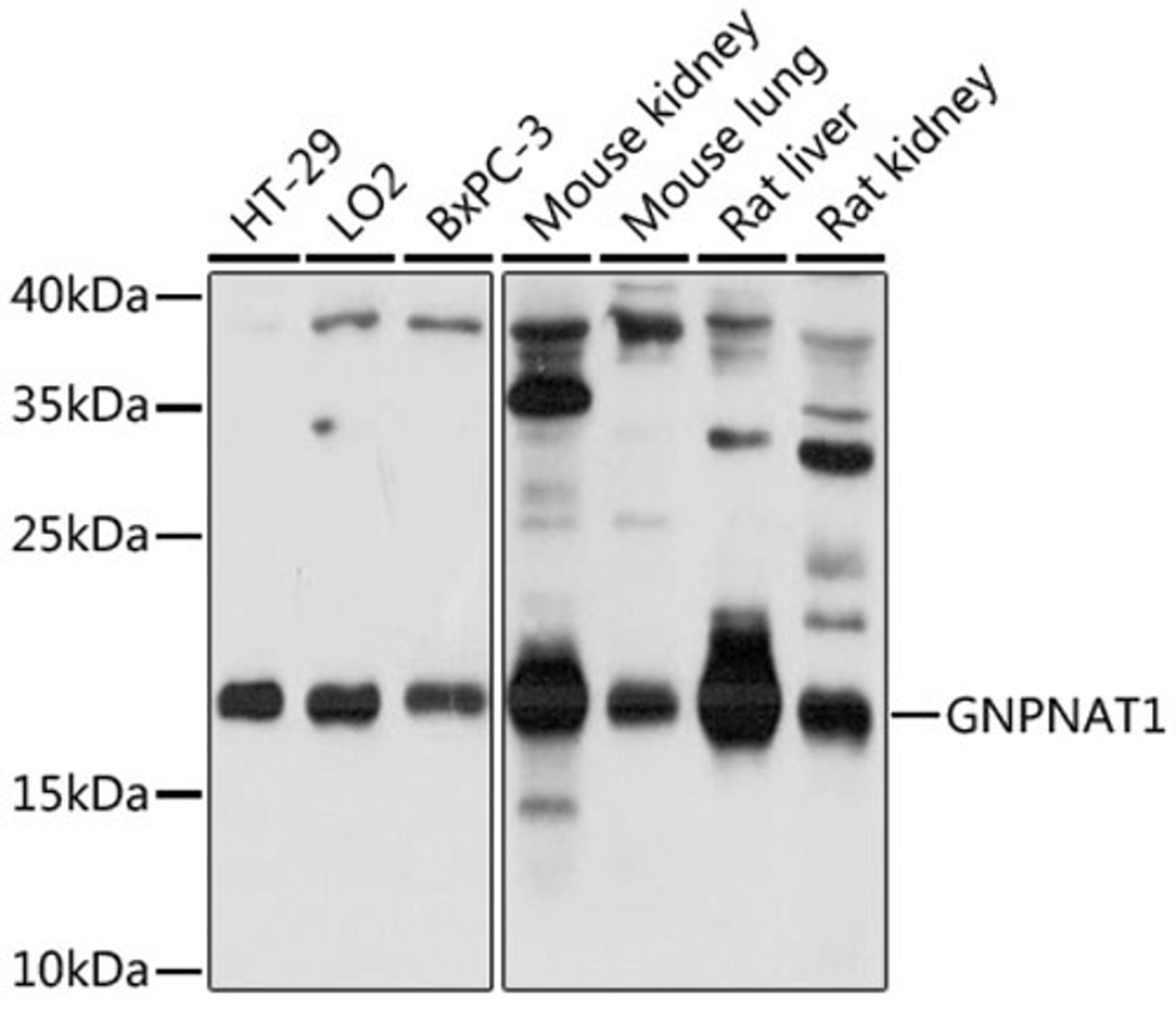 Western blot - GNPNAT1 antibody (A17759)