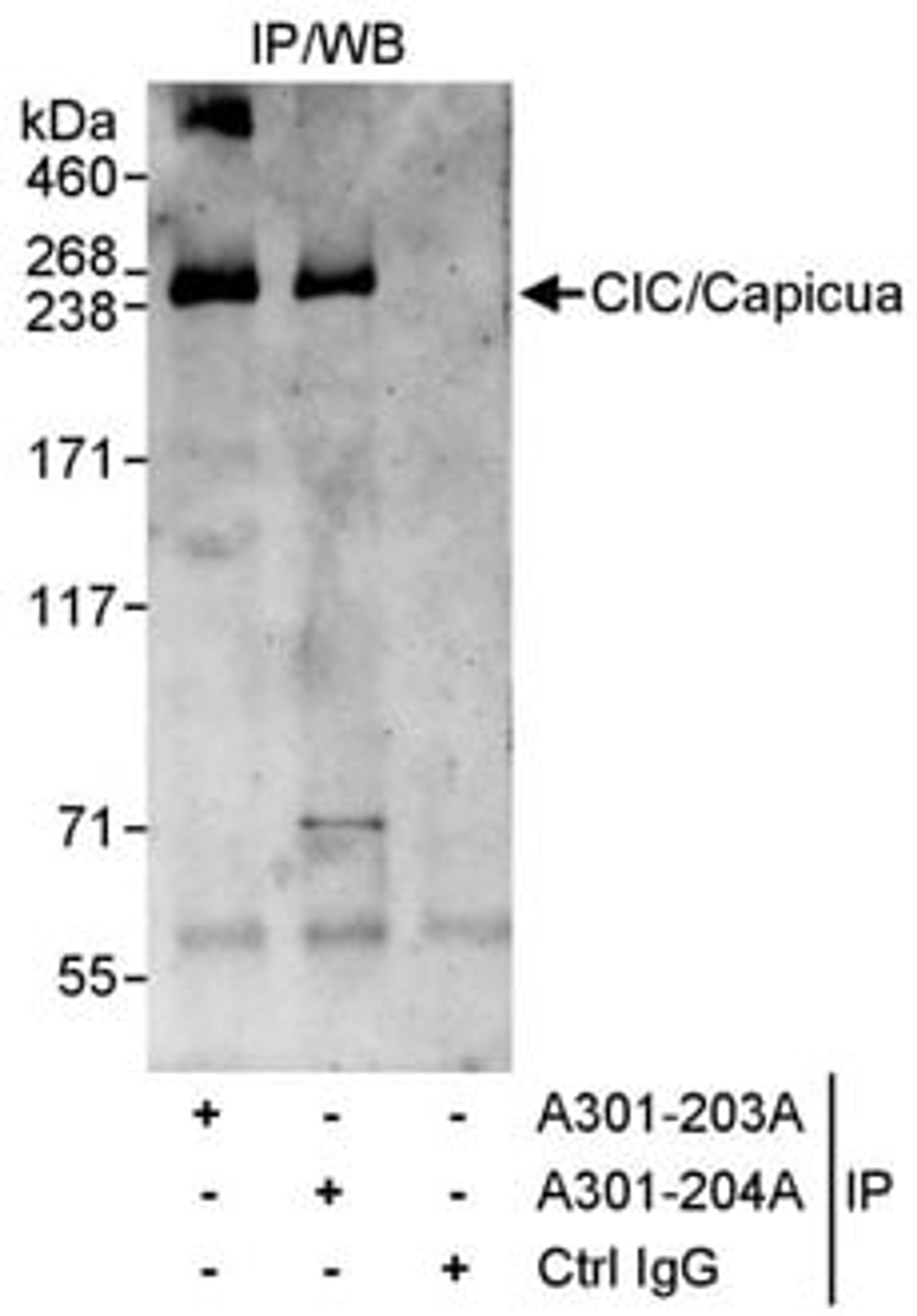 Detection of human CIC/Capicua by western blot of immunoprecipitates.