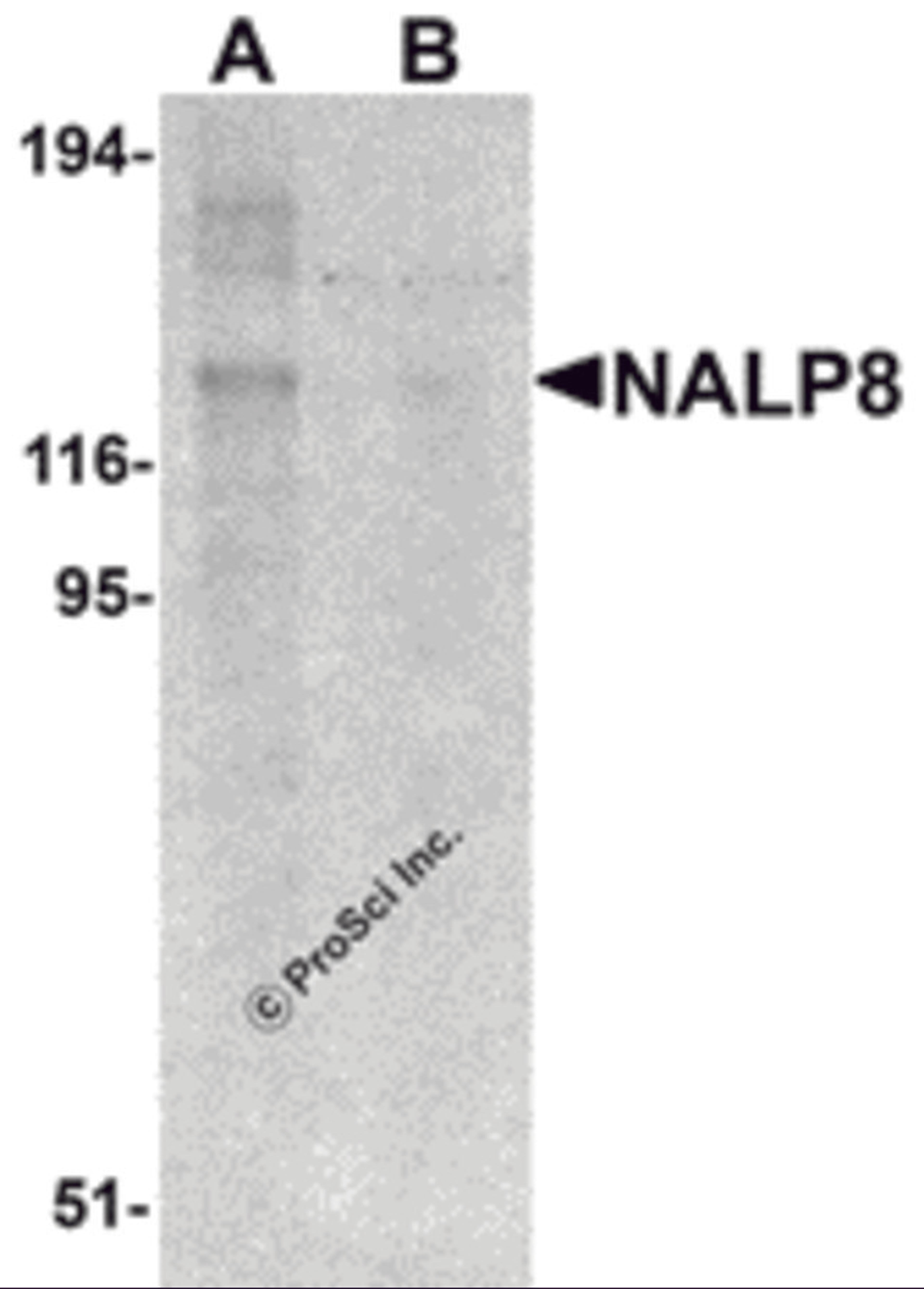 Western blot analysis of NALP8 in human colon tissue lysate with NALP8 antibody at 1 μg/mL in (A) the absence and (B) the presence of blocking peptide.
