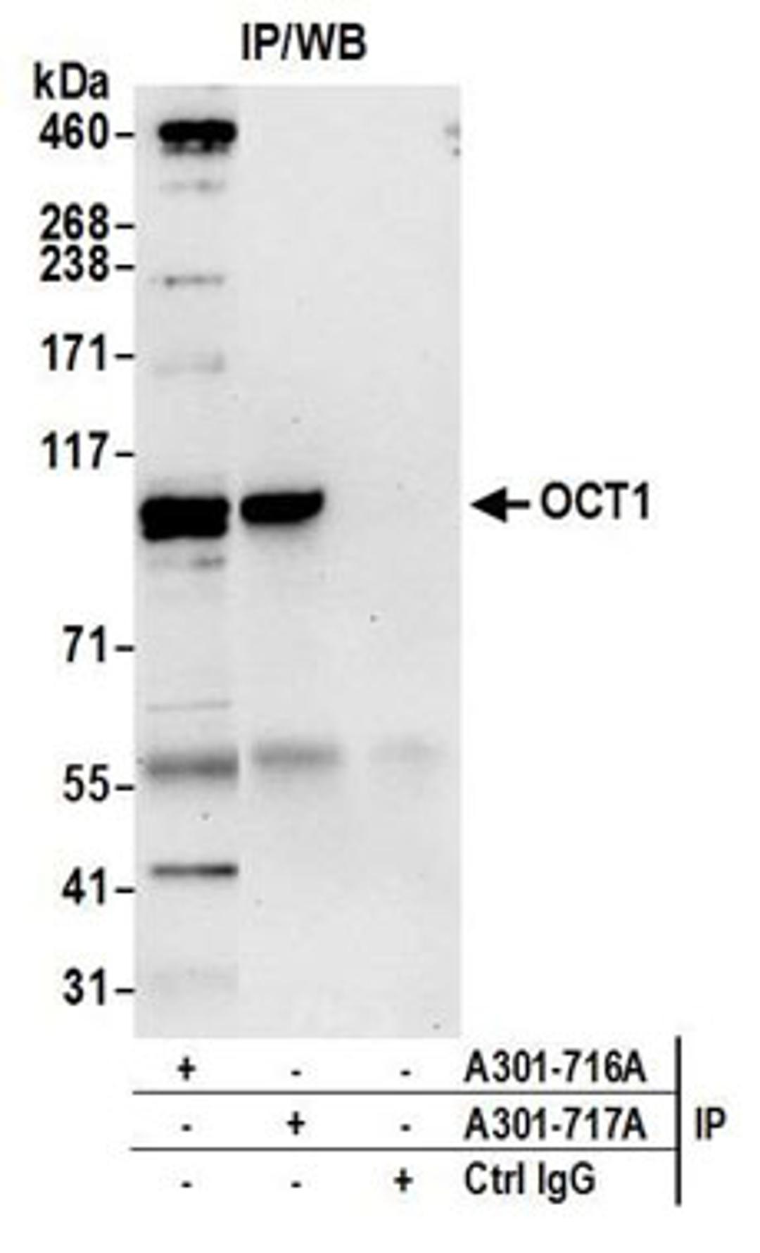 Detection of human OCT1 by western blot of immunoprecipitates.