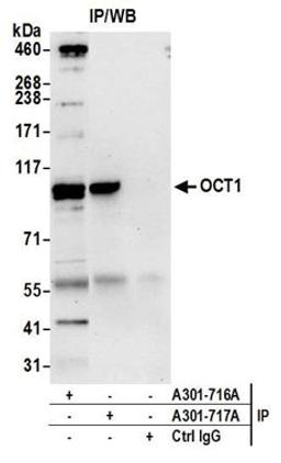 Detection of human OCT1 by western blot of immunoprecipitates.