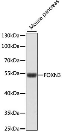 Western blot - FOXN3 antibody (A15039)