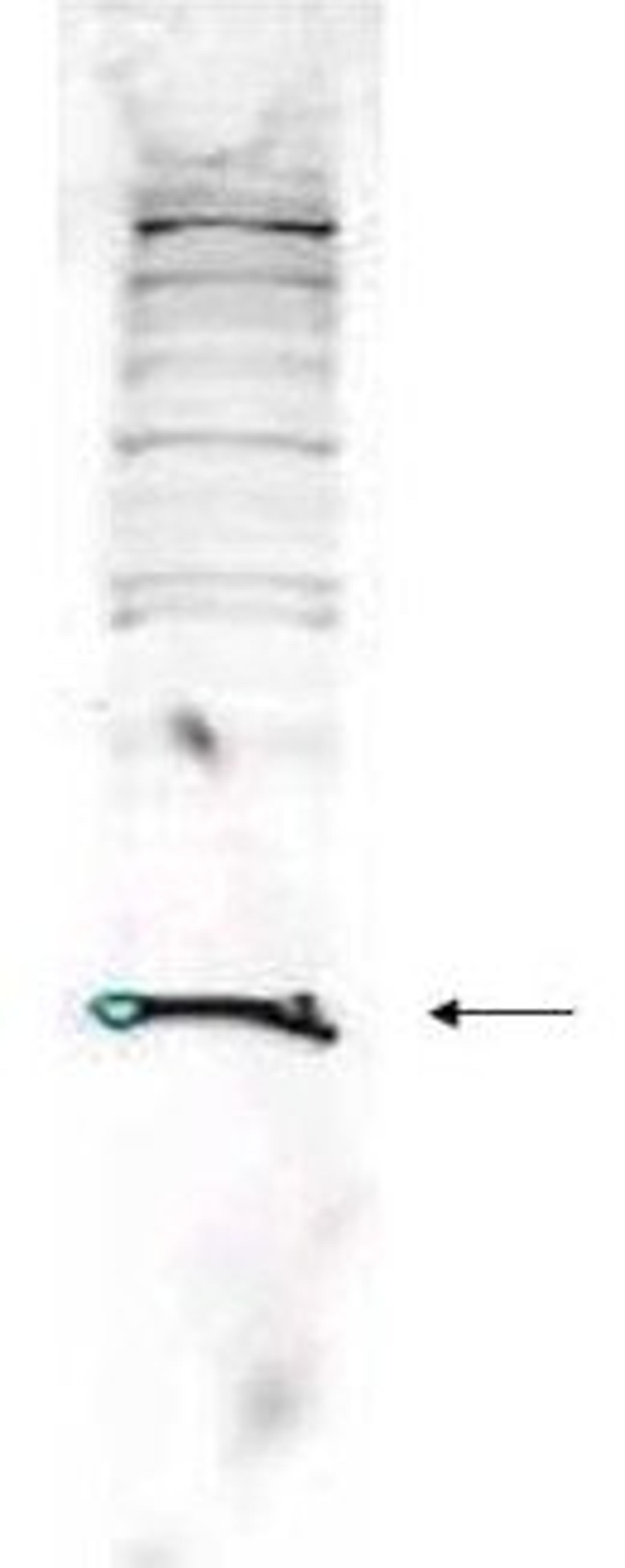 Western blot analysis of Jurkat whole cell lysate using PARK-7 antibody