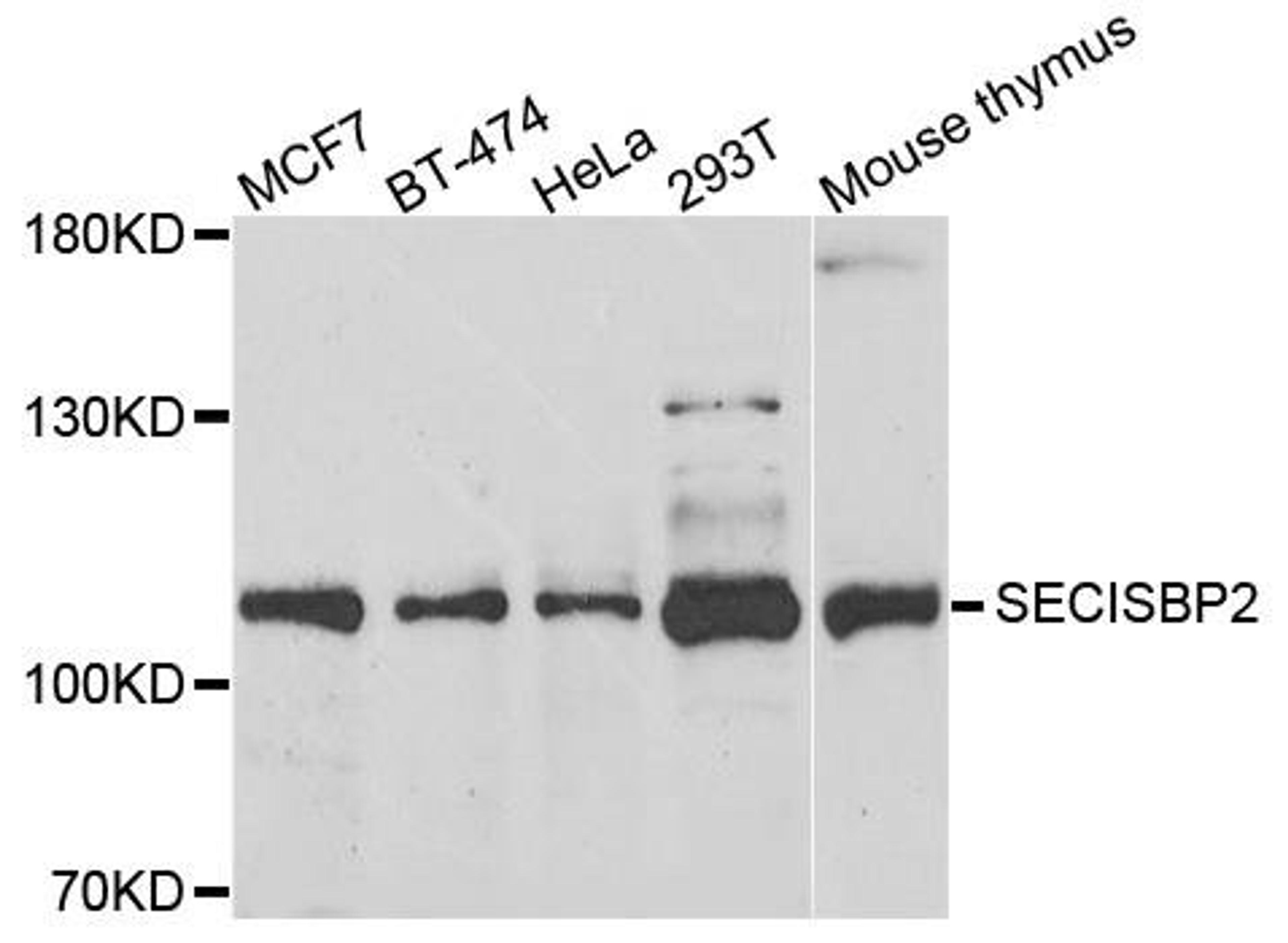 Western blot analysis of extracts of various cells using SECISBP2 antibody