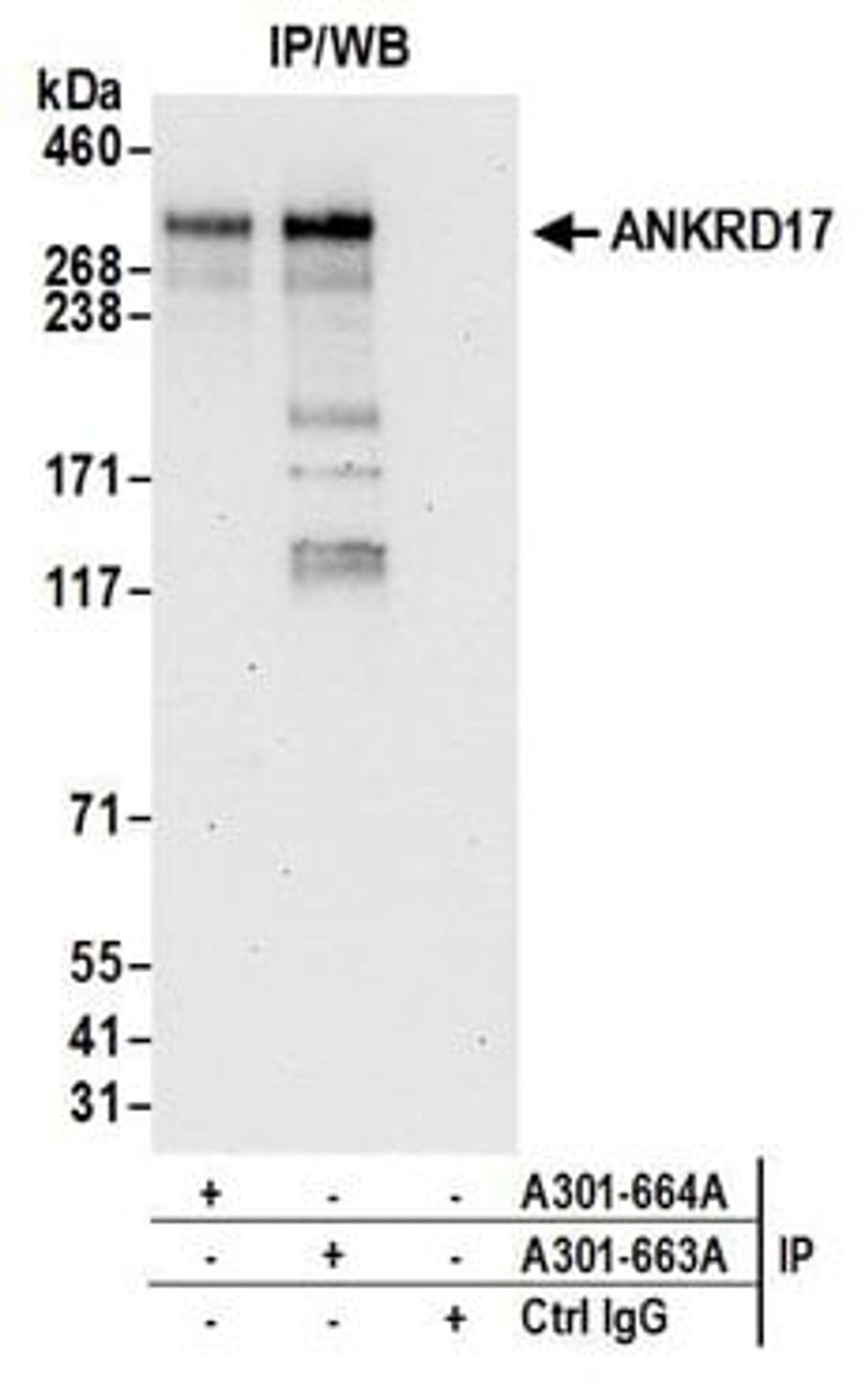 Detection of human ANKRD17 by western blot of immunoprecipitates.