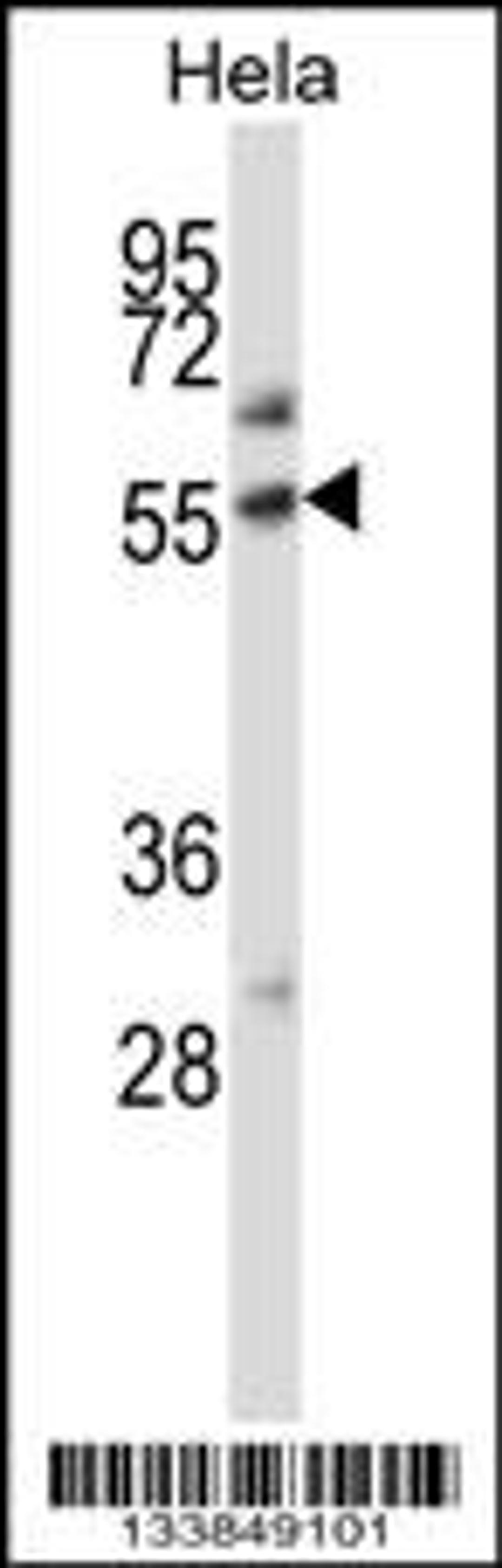 Western blot analysis in Hela cell line lysates (35ug/lane).