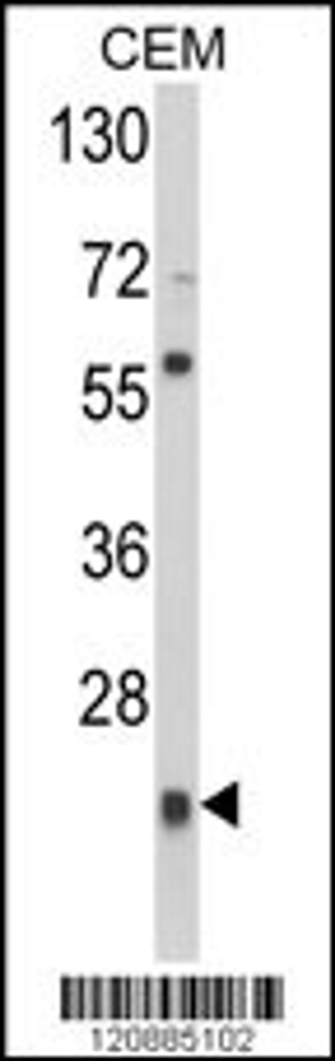 Western blot analysis of PRDX1 Antibody in CEM cell line lysates (35ug/lane)